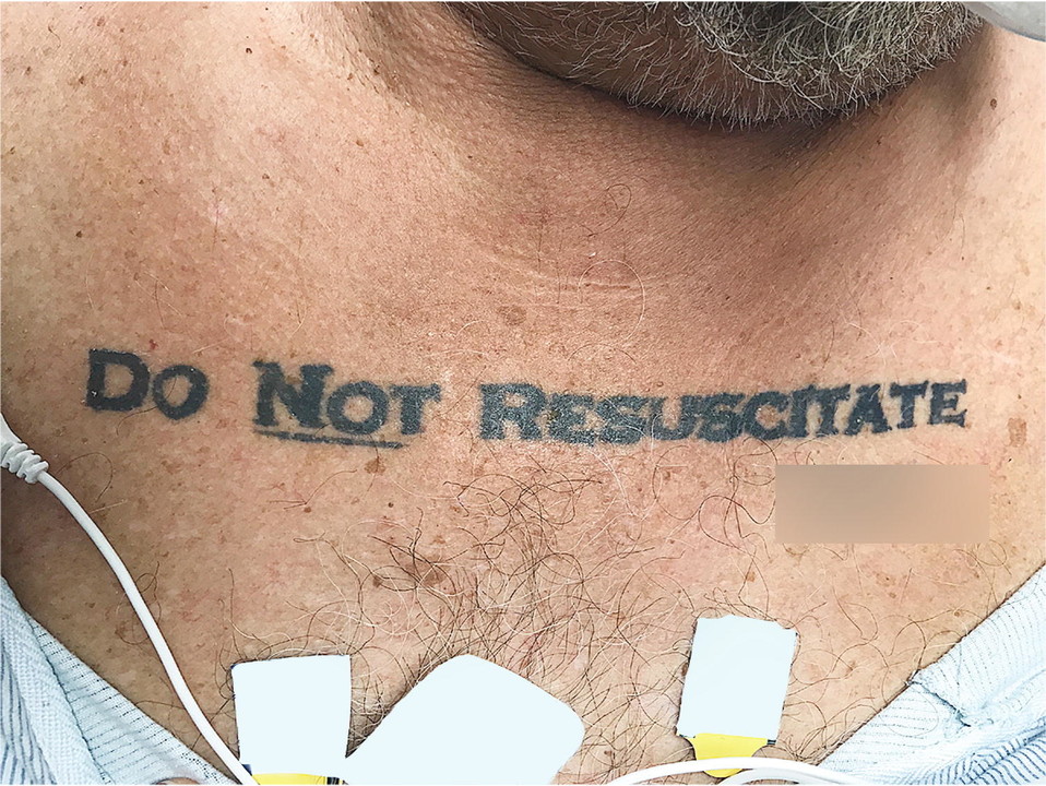 Meaning malay resuscitate in Do not