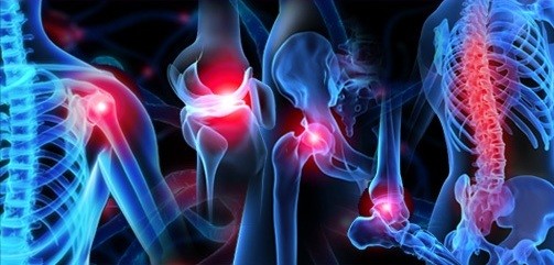 Palmetto Bone & Joint | LinkedIn