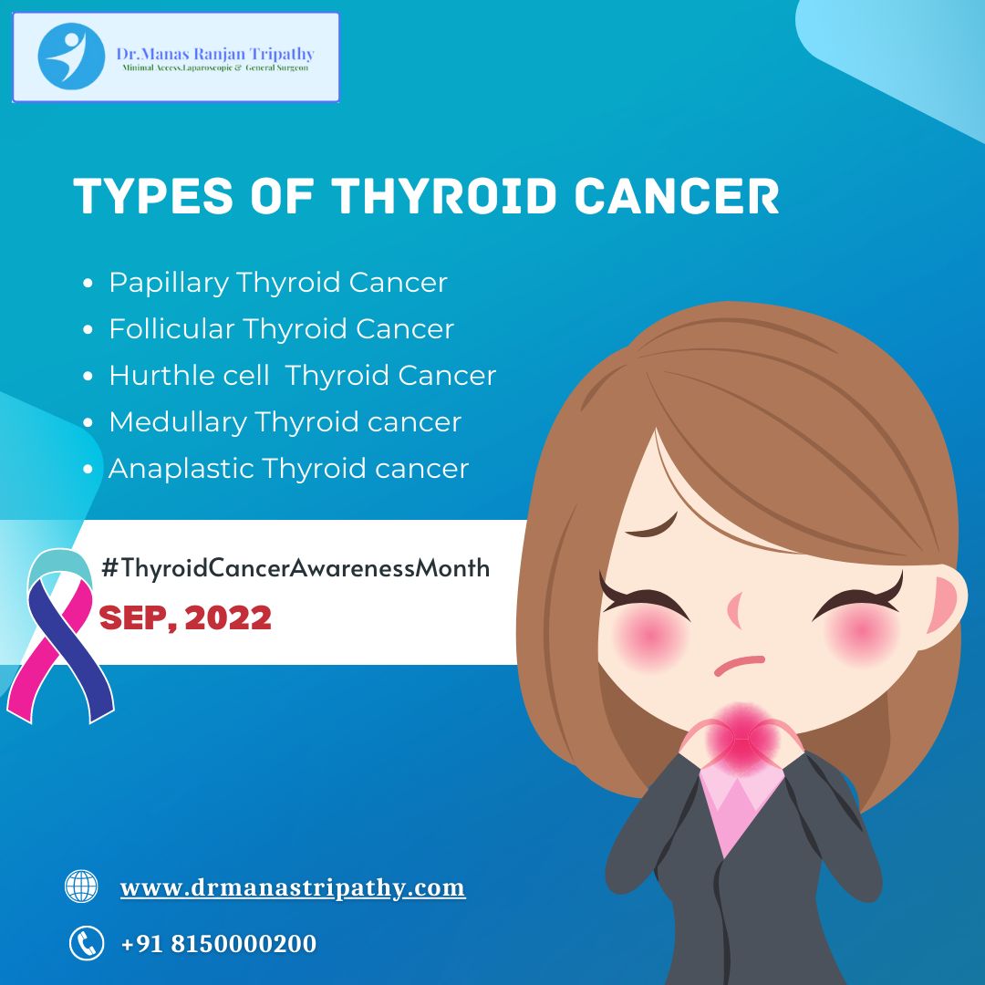 Dr Manas Ranjan Tripathy on LinkedIn: #cancer #ThyroidCancer # ...